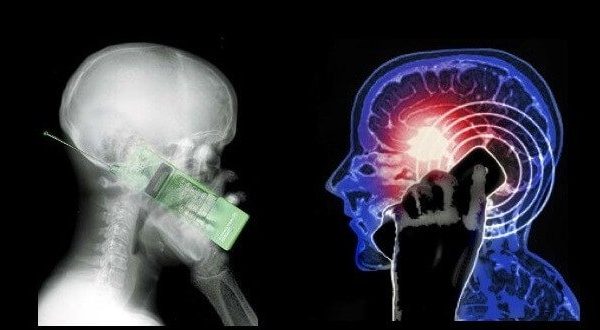 Quali effetti hanno gli apparecchi elettronici sul cervello?