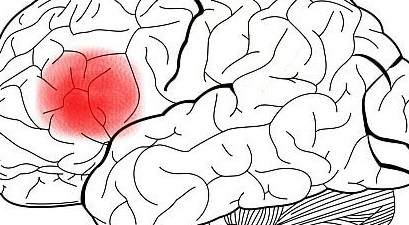 Area di Broca e produzione del linguaggio