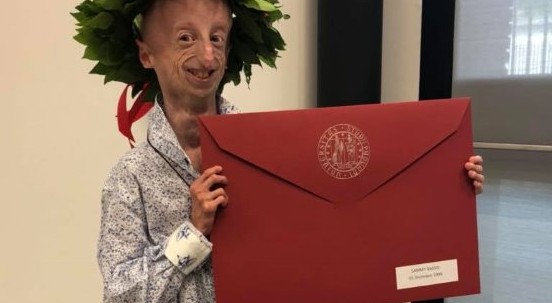 Sammy si laurea: 110 e lode con una tesi sulla sua malattia