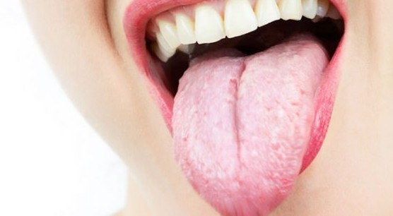 Dal colore e dalla forma della tua lingua puoi capire se stai bene o male