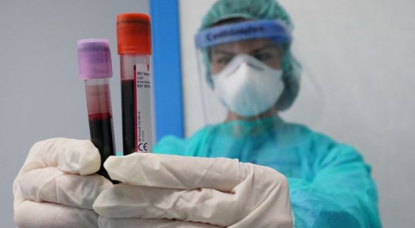 Coronavirus, 8.292 nuovi casi e 139 decessi nelle ultime 24 ore