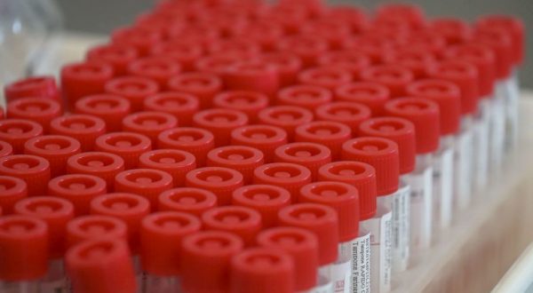 Tumori, è made in Italy la terapia intelligente