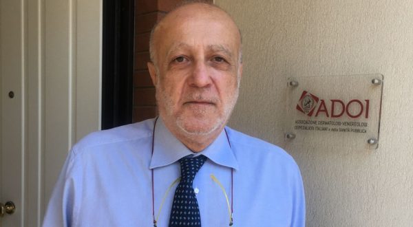 Sos psoriasi, dermatologi ADOI istituiscono numero verde per i pazienti