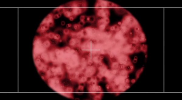 Pregliasco “Vaccino e buonsenso armi per combattere covid e vaiolo”