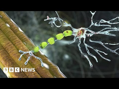 ‘Truly remarkable’ drug can reverse decline caused by motor neurone disease – BBC News