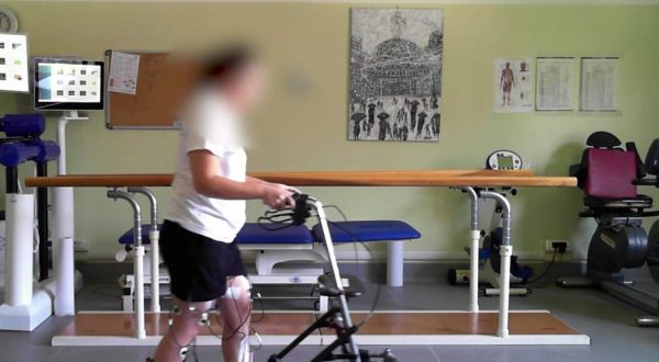 Un neurostimolatore midollare per camminare dopo una lesione spinale