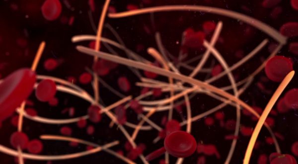 Lupus eritematoso sistemico, testata nuova terapia