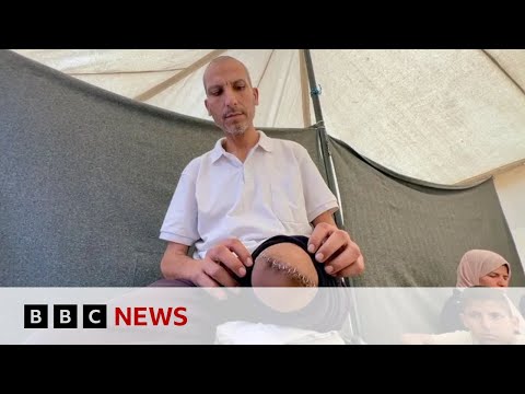 Gazans ‘shackled and blindfolded’ at Israel hospital, whistle-blowers say | BBC News