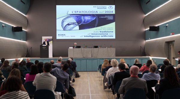 Fegato grasso, ne soffre il 25% degli italiani