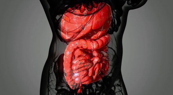 Calcoli della colecisti, una patologia comune ma spesso asintomatica