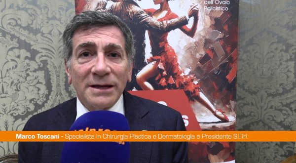 PCOS, Toscani “Acne e alopecia segni clinici principali”