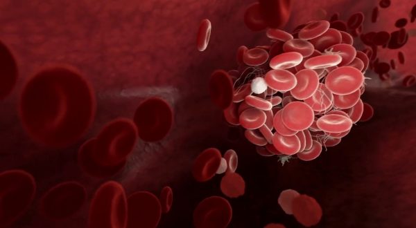 Ormoni e coagulazione, una relazione “pericolosa”