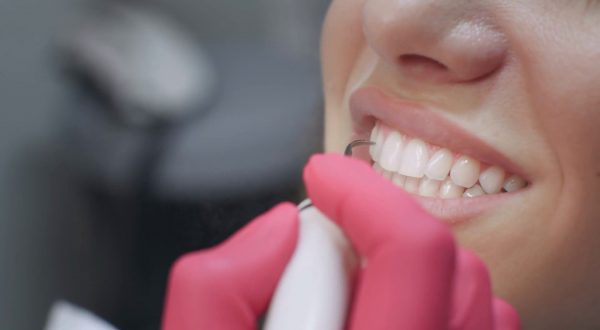 La parodontologia e la ricetta per “salvare” i nostri denti