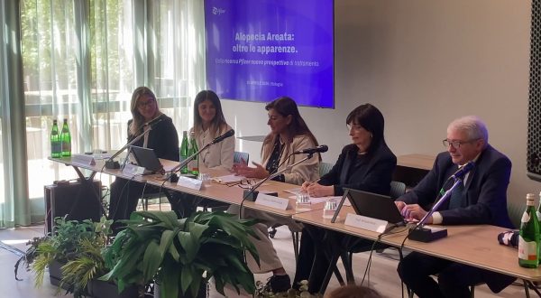 Alopecia, da Pfizer un nuovo trattamento