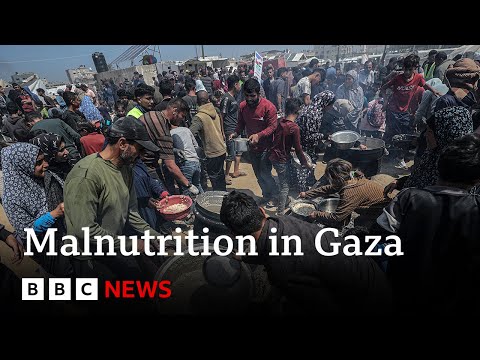 Malnutrition rises in Gaza as Israeli blockade enters third month | BBC News