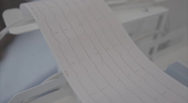 Amiloidosi cardiaca, istituito un gruppo di lavoro