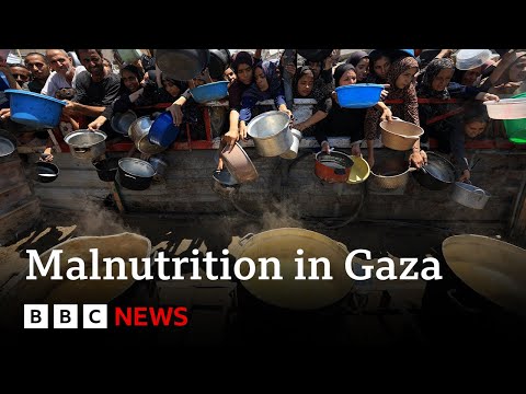 Gaza health ministry says 33 people dead from malnutrition in last 48 hours | BBC News