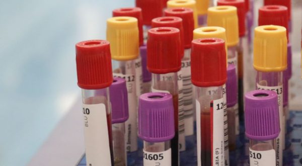 Botulino, dal 2001 al 2024 segnalati 1.276 casi in Italia