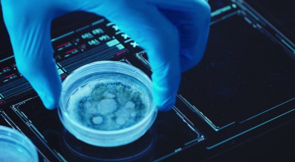 Malattie rare, la diagnosi adesso si fa con la tomografia olografica