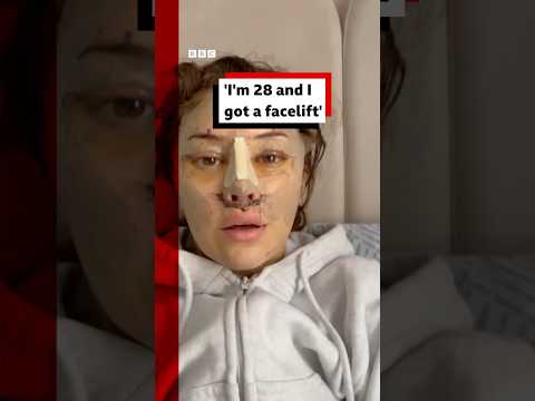 “I’m 28 and I got a facelift”. #Facelift #PlasticSurgery #BBCNews