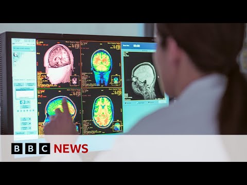 Adolescence lasts into 30s, new study shows | BBC News