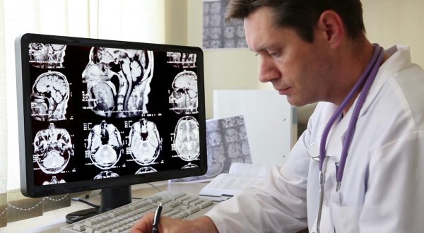 Epilessia, una malattia dalle varie forme