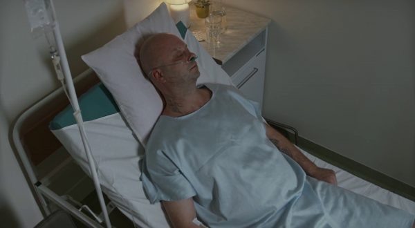 Ustioni, nelle forme più gravi diventano malattia sistemica