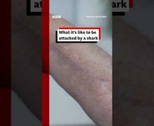 What it's like to be&nbsp;attacked by a shark. #Sharks #SharkAttack #BBCNews