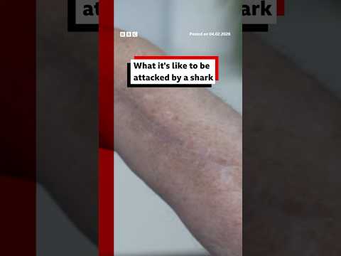 What it's like to be&nbsp;attacked by a shark. #Sharks #SharkAttack #BBCNews