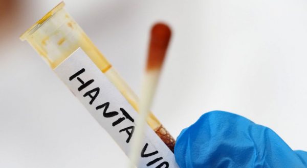 Hantavirus, negativa la paziente argentina ricoverata al Policlinico di Messina
