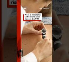 Melanoma skin cancer cases hit UK record high. #BBCNews