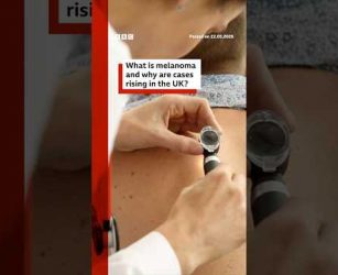 Melanoma skin cancer cases hit UK record high. #BBCNews