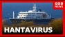 Second hantavirus case confirmed after three die in suspected cruise ship outbreak | BBC News