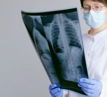 Il Covid ha cambiato percezione malattie respiratorie, nuova attenzione a rischi