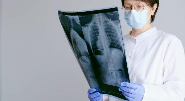 Il Covid ha cambiato percezione malattie respiratorie, nuova attenzione a rischi