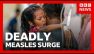 Inside a Bangladesh hospital during a deadly measles outbreak | BBC News